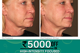 How To Get Tighter Firmer Skin With Laser Skin Tightening