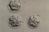 An image of three 16-cell blastocysts during a process of in vitro fertilization (IVF).