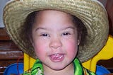 A face shot of a cute little girl who has Down syndrome