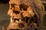 The Skull Clad in Medieval Chainmail from a Mass Grave on the Island of Gotland