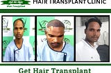 Hair Transplant in Ludhiana