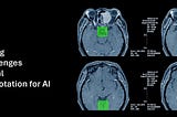 medical data annotation