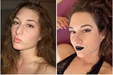 I Have Mixed Feelings About My Nose Job