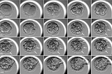 Computer vision for in-vitro fertilization (IVF)