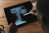 A person examines a digital X-ray image of a cervical spine displayed on a tablet, using a pen to point at a specific vertebra — illustrating medical analysis or patient consultation in a clinical or educational setting. Reflecting the perspective of Ramneek Bhogal on the role of upper cervical chiropractic in nervous system regulation.