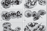 Consequence of Gamma Radiation Induced Cytomixis during Microsporogenesis in Fennel Plant…