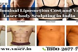 Laser Liposuction Cost in Delhi, Banglore, India