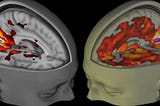 Psychedelics and Psychiatry: Why Psychiatrists Need to Stay Informed