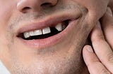 Pat Crawford DDS — Affordable Dental Implants in Kenosha