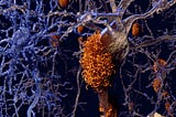 Taufold — Alzheimer’s Blood Test
