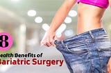 What You Should Know About the Benefits of Bariatric Surgery?