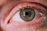 Close-up photo of an eye with a reflection on the cornea