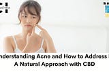 Understanding Acne and How to Address It: A Natural Approach with CBD