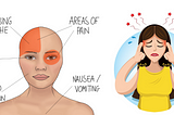 Throbbing headaches, also known as pulsating headaches, are a type of pain characterized by a rhythmic, pulsating sensation. This sensation often accompanies the headache, giving the impression of a steady, throbbing beat. These headaches can result from various causes, including stress, tension, migraines, or underlying health conditions.
 
 The throbbing sensation is usually felt on one or both sides of the head and can range from mild discomfort to intense pain. Throbbing headaches are often