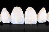 Dental Crowns in one day CAD/CAM Technology