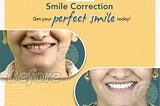 Best Dentist In Indore and Dental Clinic