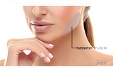 The Rising Trend in Med Spas: Masseter Treatments, It’s Not Just For Looks But Can Help With Teeth…