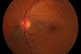 In Pursuit of Neurogenesis