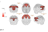 How to Highlight 3D Brain Regions