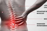 4 most common and severe causes of back pain