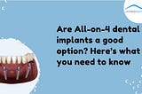 Are All-on-4 dental implants a good option? Here’s what you need to know