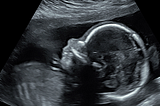 Violent tax-payer funded experiments performed on aborted fetuses
