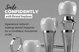 Miami’s Top Dental Implants: Restore Your Confidence