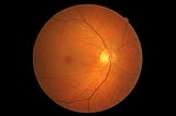 Detecting eye disease using AI (kaggle bronze place)