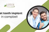 Best Tooth Implant in Campbell: A Guide to Lotus Dental Group