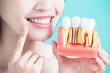 5 Benefits of Getting Dental Implants in India