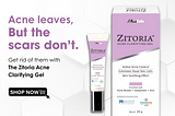 Say Goodbye to Acne with Zitoria Acne Clarifying Gel!