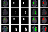 Brain Tumor classification and detection from MRI images using CNN based on ResU-Net Architecture