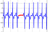 Outliers Analysis in Machine Learning