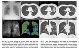 Case Study: COVID-19