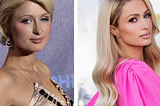 Paris Hilton Aesthetic Procedures and Nose Reconstruction
