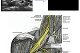 Ultrasonic Nerve Segmentation