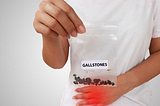 What are Gallstones? 3 Dangers to Leaving Them Untreated