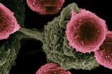 Pancreatic Cancer Is Often Diagnosed Late. The Clues to Catch It Earlier May Already Exist