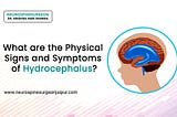 What are the physical sign and symptoms of hydrocephalus?