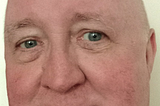 Image of Fraser used to illustrate post.