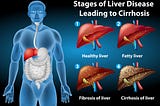 What is Non Alcoholic Fatty Liver Disease?