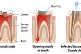 Apple Dental Group : Best Root Canal in Miami Springs, FL
