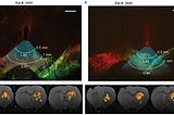 Unexpected global impact of VTA dopamine neuron activation as measured by opto-fMRI