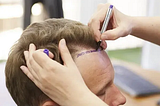 Breaking Down Hair Transplant Costs in Turkey — What You Need to Know!