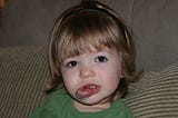 Young child with large vascular birthmark on the lip and chin.