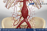 North America Aortic Stent Graft Market Size, Share, Report and Forecast 2024–2032