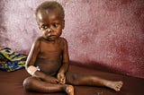 Child Malnutrition in Africa: How the African Government and the UNICEF response to it?