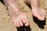 Understanding and Correcting a Hammer Toe