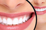 Natural Remedies For Receding Gums