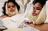 mulher deitada em cama de hospital após uma cirurgia ortognática